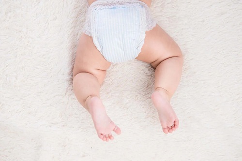 Nevoia de tratamente pentru iritația de scutec