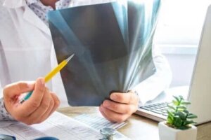 Edemul măduvei osoase: ce trebuie să știi