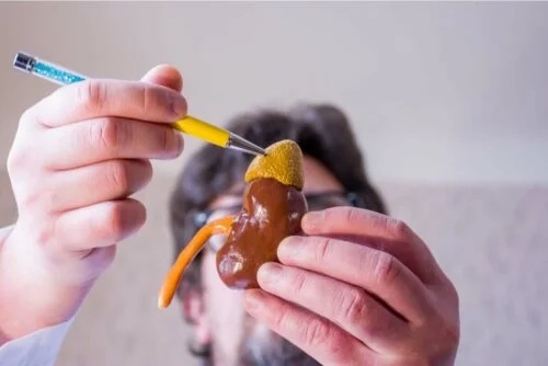 Medic care explică ce presupune scăderea nivelului de colesterol