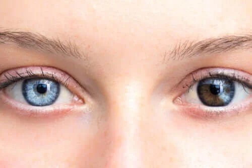 De ce apare schimbarea culorii ochilor?