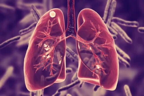 Care sunt simptomele tuberculozei pulmonare?