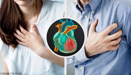 Simptomele unui infarct la femei și bărbați