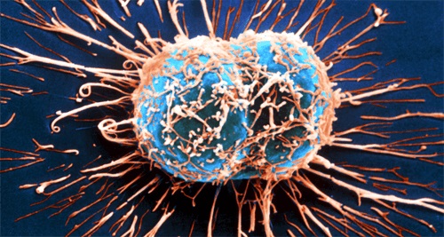 Cum luptă sistemul imunitar împotriva cancerului