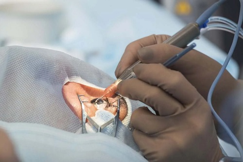 Tratament ce abordează cauzele pierderii vederii