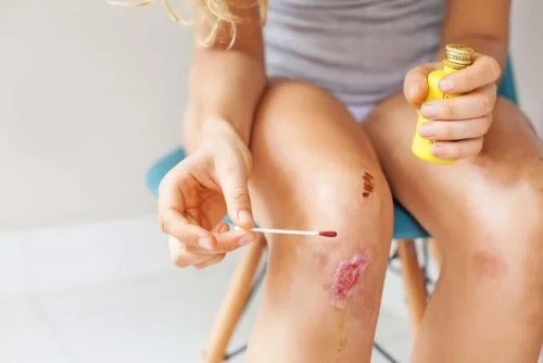 Cum se tratează o rană infectată cu antiseptice