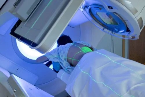 Utilizările radioterapiei pentru tratarea tumorilor