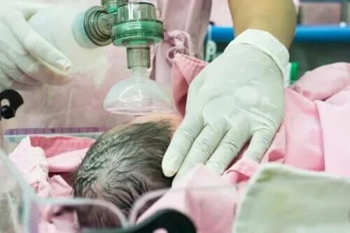 Bebeluș intubat de medic
