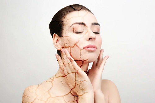 Cauzele pielii uscate la femei
