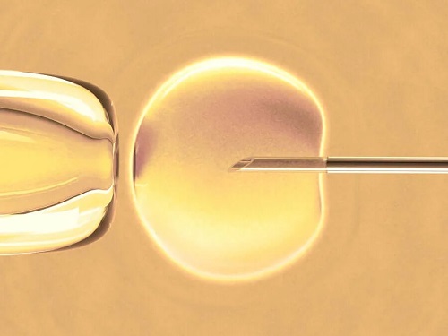 Ce este fertilizarea in vitro? Informații esențiale