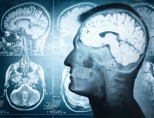 Hernia cerebrală la om