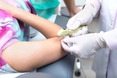 Medic care prezintă efectele secundare ale anticoncepționalelor