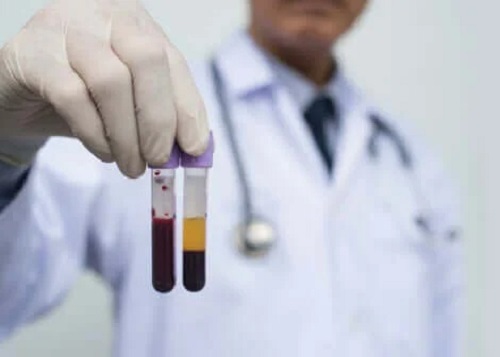 Medic care ține în mână eprubete cu sânge