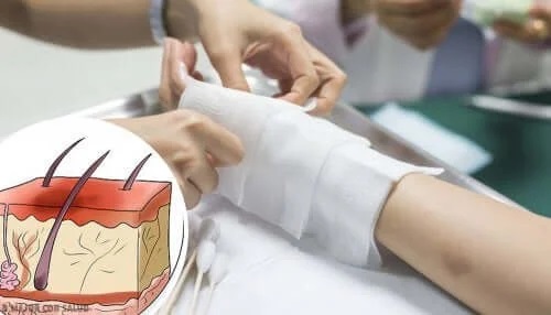 Medic ce arată cum să tratezi arsurile la copii