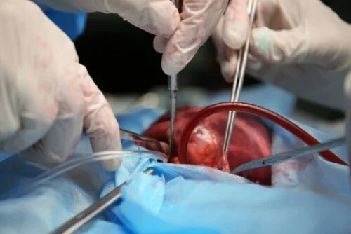 Medici care pot corecta mai multe tipuri de boli de inimă