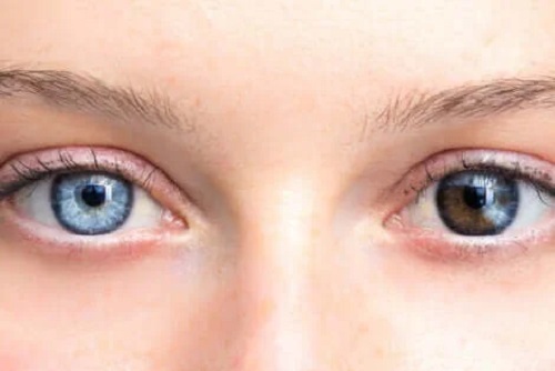 Schimbarea culorii ochilor la femei