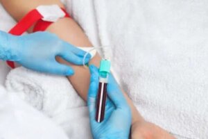 Ce sunt transfuziile de plasmă?