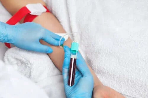 Ce sunt transfuziile de plasmă?