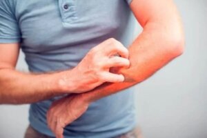 5 remedii naturale pentru mâncărime