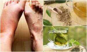 ceaiuri pentru guta poate artroza vindecării șoldului