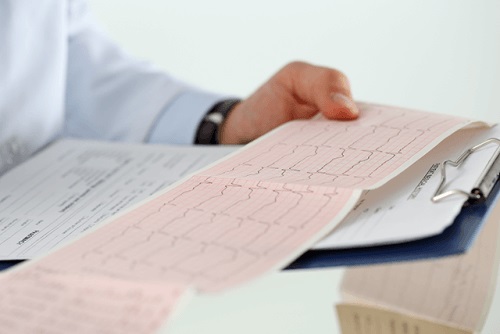 Medic care citește o electrocardiogramă