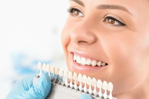 Procedurile de albire a dinților – Descriere și tipuri