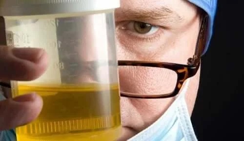 Medic ce examinează o probă de urină