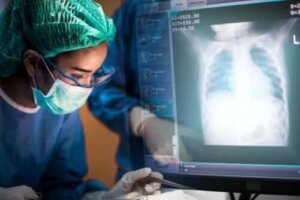 Transplantul de plămâni: tot ce trebuie să știi