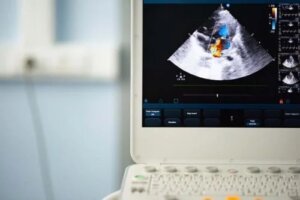 Valva aortică bicuspidă: diagnostic și tratament