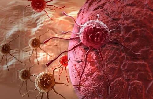 Celule canceroase în corpul uman