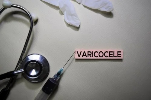 Cauzele și complicațiile varicocelului