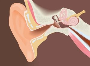 Îndepărtarea exostozelor canalului auditiv extern