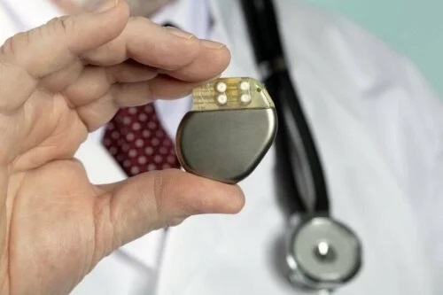 Medic care ține în mână un stimulator cardiac