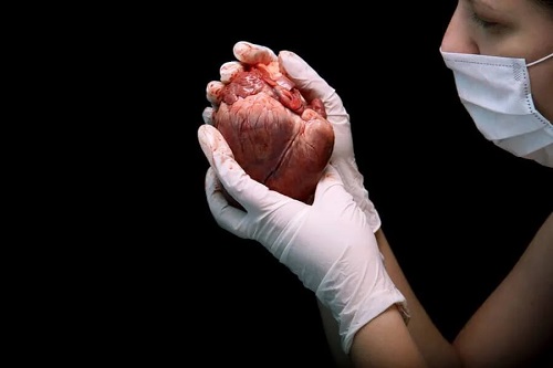 În ce constă transplantul de inimă?