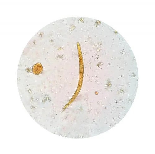 Parazit la microscop