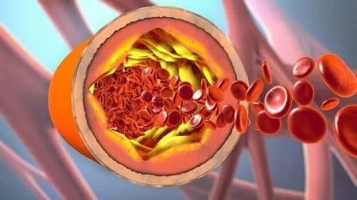 Celule sanguine în artere