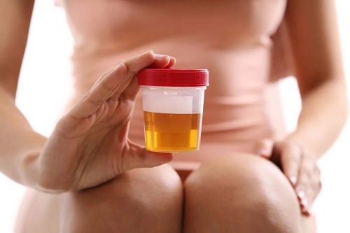 Femeie care ține o probă de urină