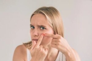5 remedii naturale pentru furuncule