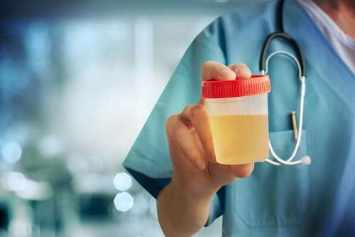 Specialist care explică la ce folosește urocultura