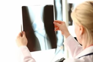 Alimente bogate în vitamina D și calciu pentru oase