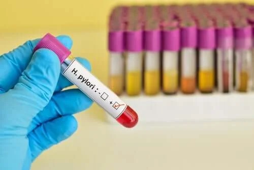 Analize pentru tratamentul ulcerului gastric