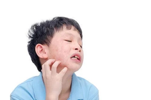 Copil care are nevoie de tratamentul oreionului