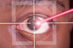Intervenția chirurgicală LASIK: avantaje și riscuri