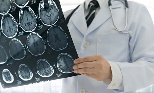 Medic care examinează leziunile cerebrale traumatice