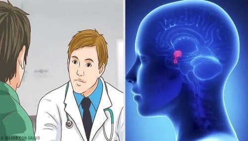 Medic care prescrie tratamentul acromegaliei
