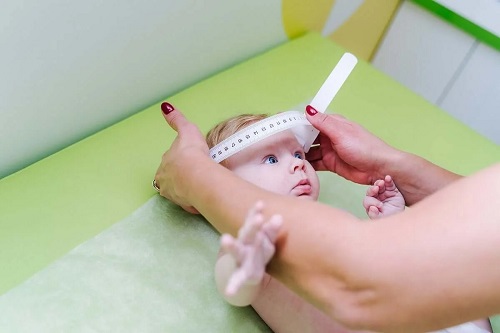Medic care se ocupă de tratamentul craniosinostozei