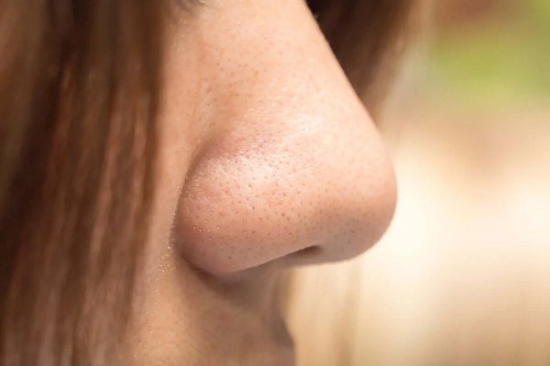 Nasul unei femei cu fantosmie
