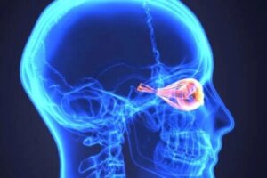 Neuromielita optică sau boala Devic: ce este?
