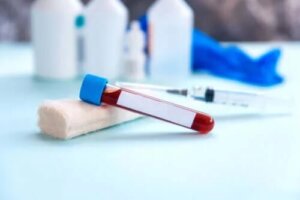 Rata de sedimentare a eritrocitelor: în ce constă?