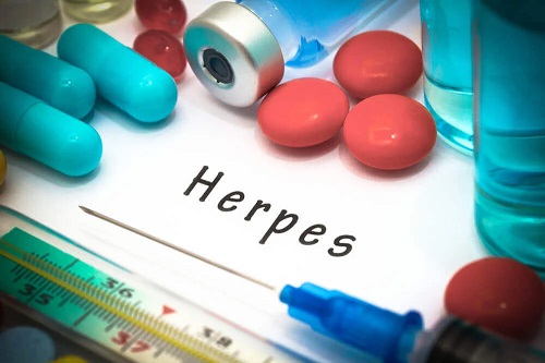 Tratament pentru herpesul oral sub formă de pilule