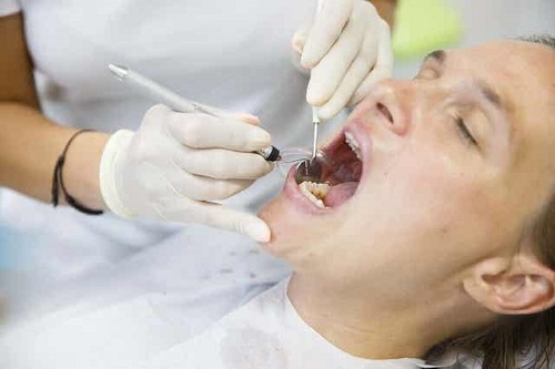 Dentist tratând cauzele dinților pătați